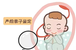 楚雄产前亲子鉴定正规机构在哪里，楚雄孕期亲子鉴定结果到底准不准确