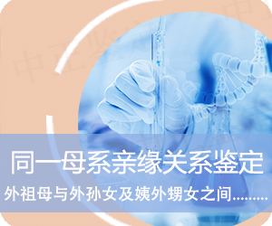 楚雄同一母系亲缘关系鉴定